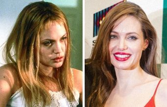 15 знаменитостей, которые боролись с зависимостью и победили